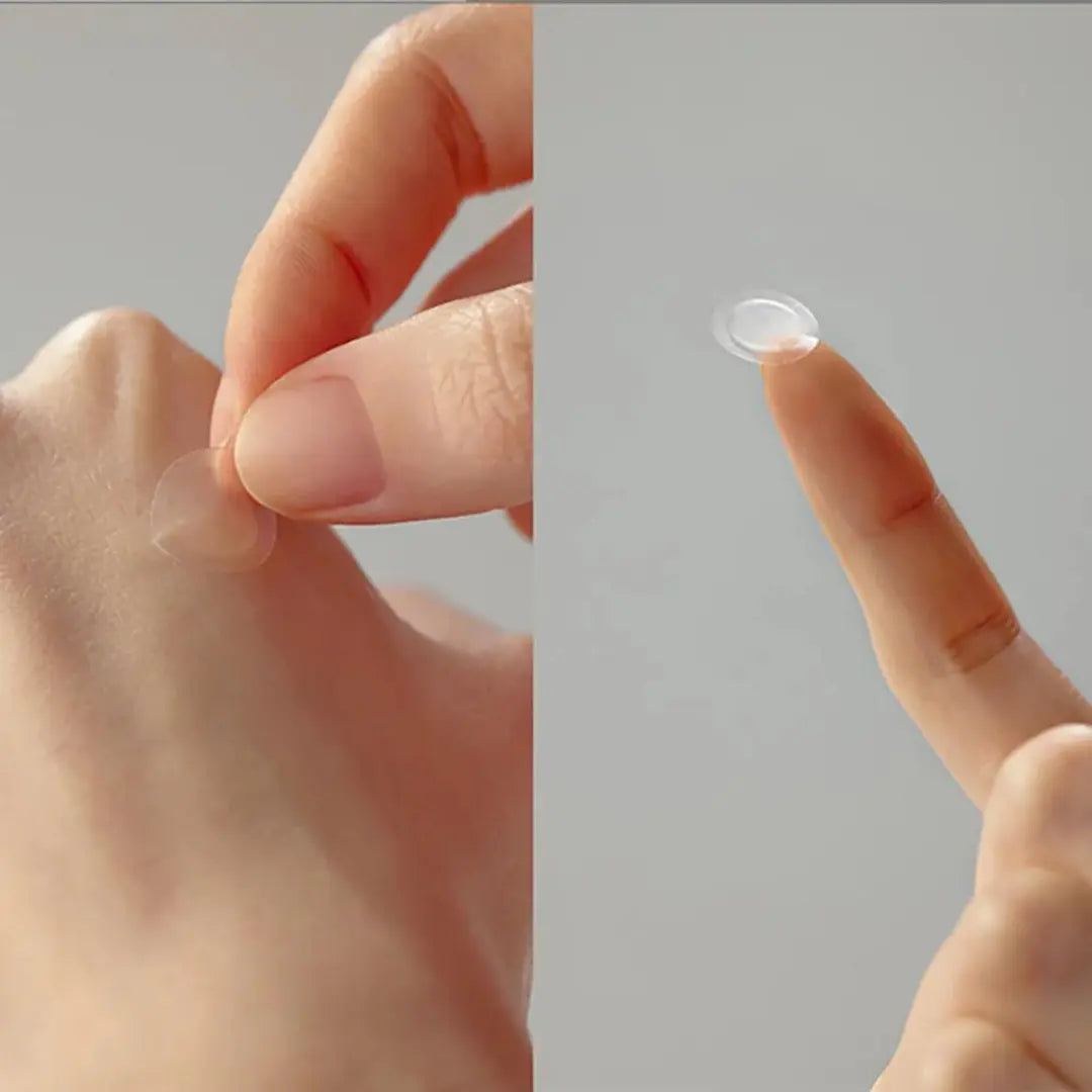30 Days Miracle Clear Spot Patch Some by Mi