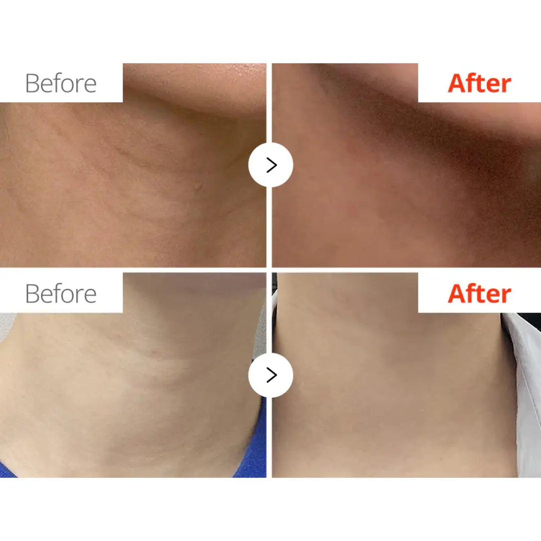 Necksphalt ECM Ceramide Neck Cream - 50 ml Dr. Melaxin